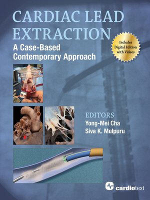 cover image of Cardiac Lead Extraction